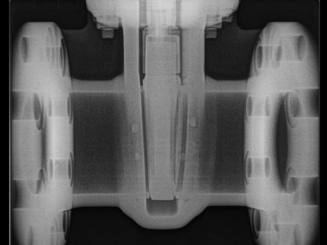 X-ray image of the valve